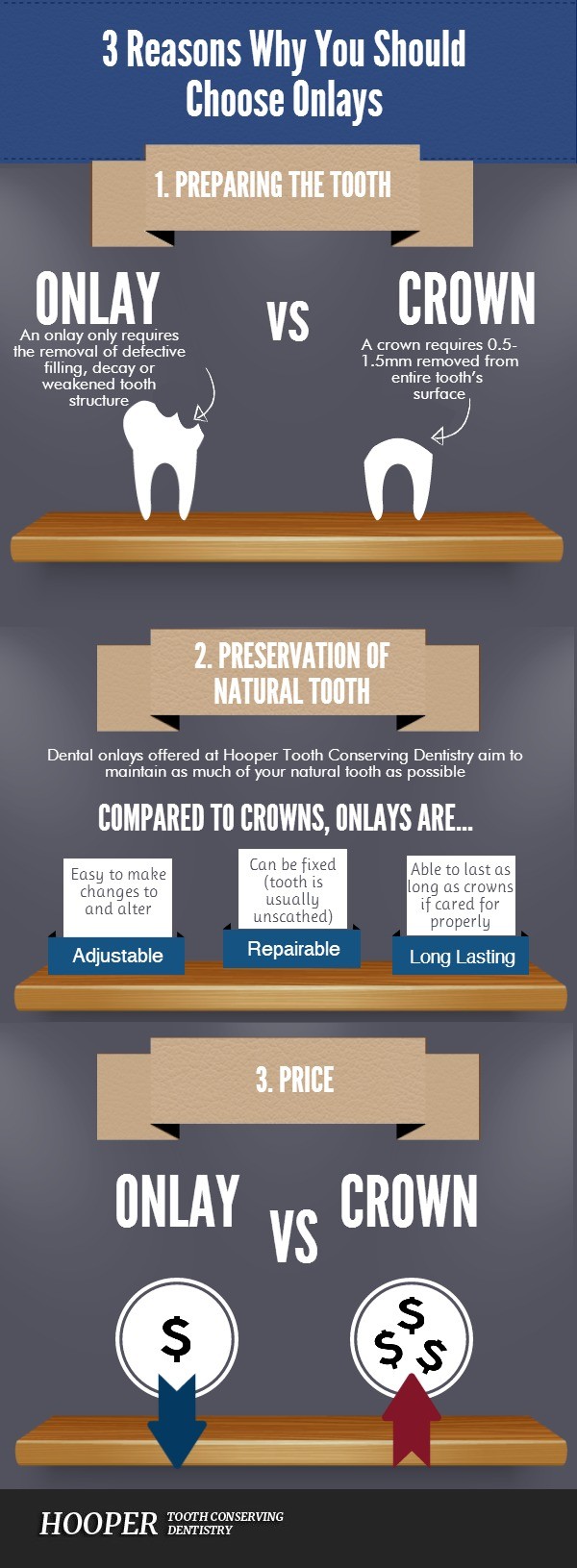 A dentist might see a broken tooth and say it needs a crown but is it the best restoration? Hooper Tooth Conserving Dentistry in Rose Bay explains onlays.
